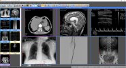Sante-DICOM-Viewer-Pro.jpg
